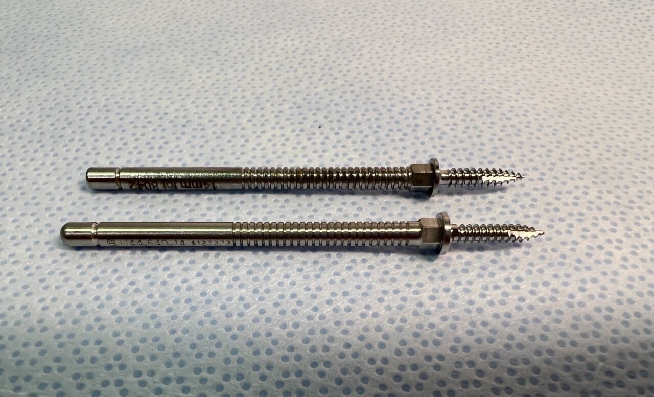SYNTHES U44.640.14 Cervical Distractor Pin 14mm