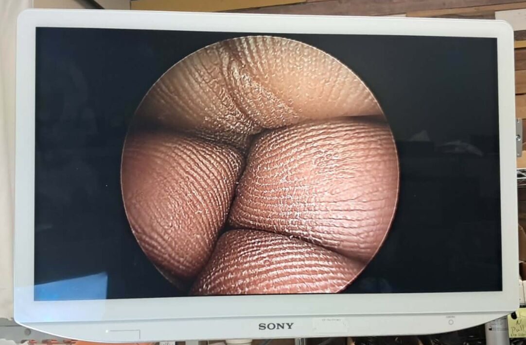 R. WOLF 8912.401 Laparoscope — photo 10