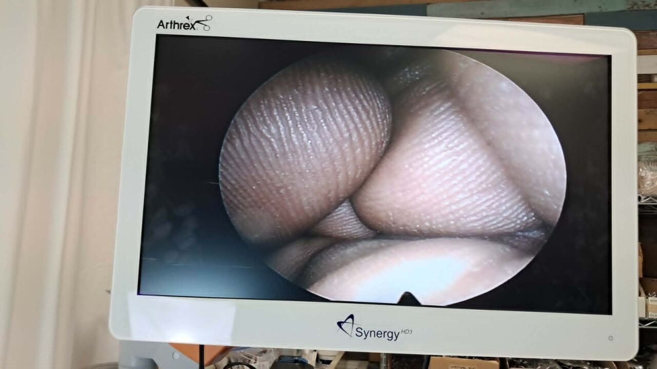 RICHARD WOLF 8880.433 Panoview Plus Arthroscope — photo 7