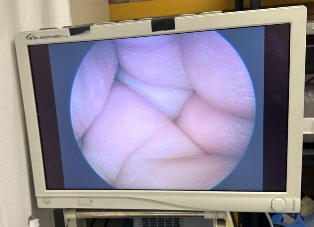 R. WOLF 4939.31 Laparoscope — photo 2
