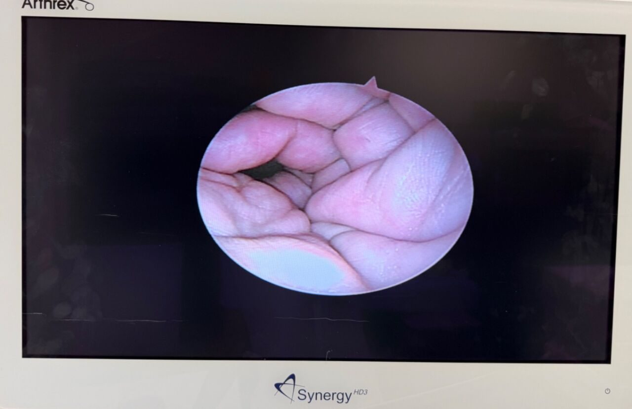 STRYKER 4mm 30deg & 70deg C-Mount Arthroscopes w/ Hardware & Extras Arthroscope — photo 5