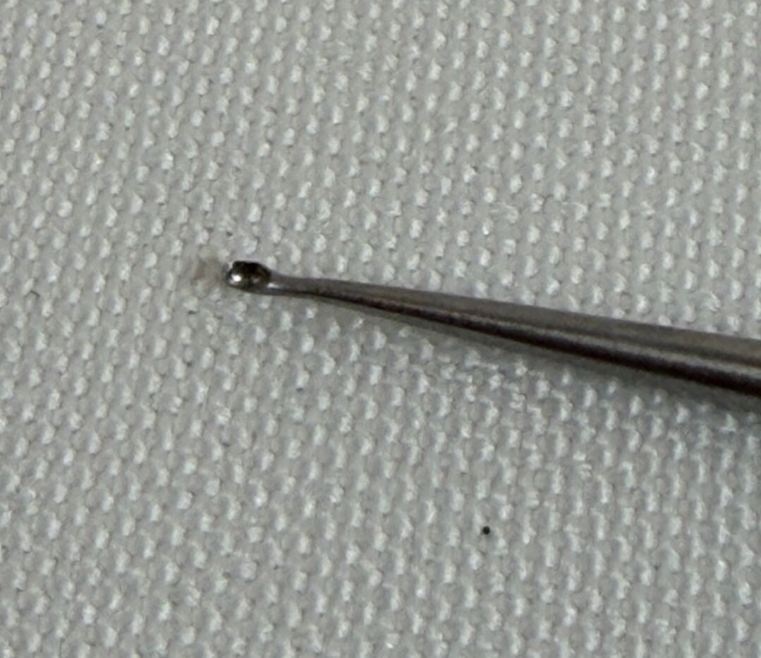V. MUELLER AU13725 Paparella Stapes Double Ended Ear Curette 0.9mm x 1.5mm Cups — photo 4