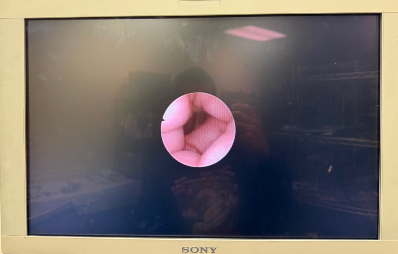 KARL STORZ 11161C1Â Flexible Neuro-Fiberscope Steerable 0Br Fibers w/ Tray   Acc. — photo 2