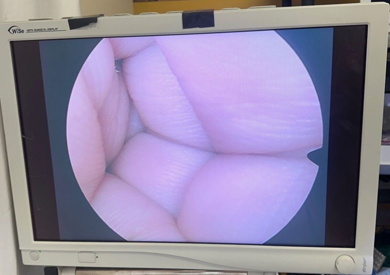 R. WOLF 8912.431 10.0 mm 0o Operative Panoview Autoclavable Laparoscope — photo 2