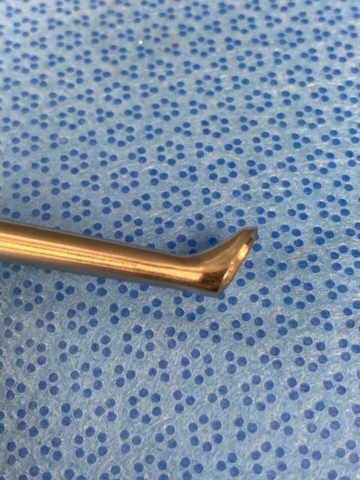 ACROMED Size 1 Push Curette Spinal Reverse Angle Spinal Curette — photo 5