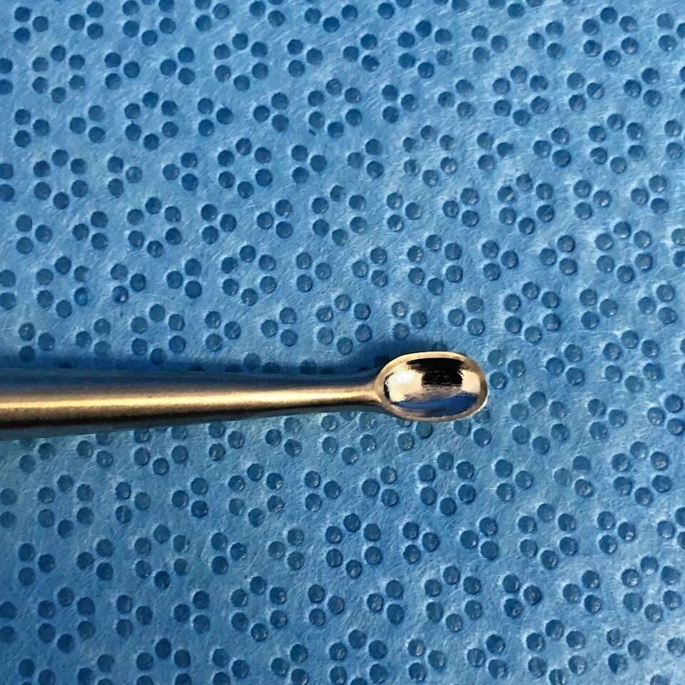 V. MUELLER OS992-002 Bruns Straight Curette Orthopedic — photo 5