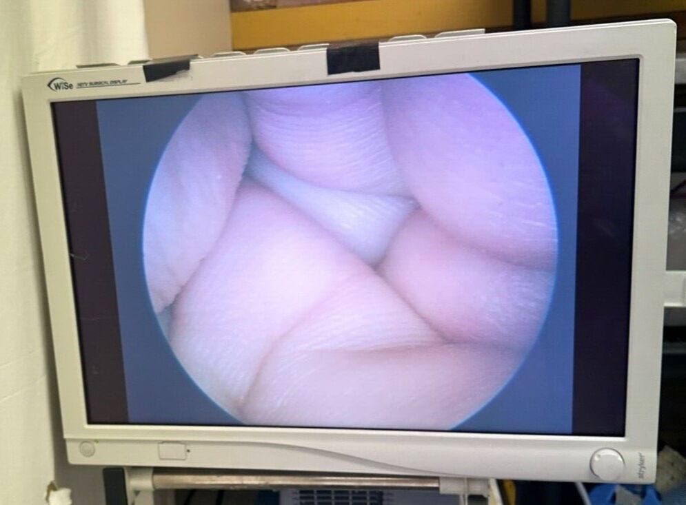 R. WOLF 4939.31 Laparoscope — photo 8