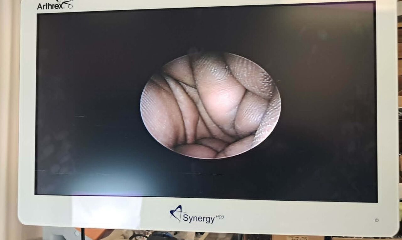 STRYKER 502-526-070 2.7mm 70° Autoclavable C-Mount Arthroscope — photo 8