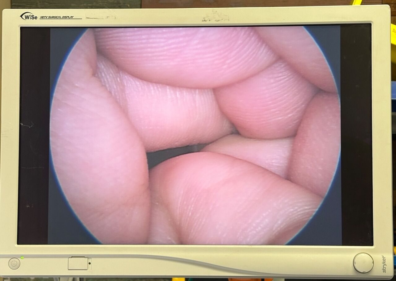 R. WOLF 8932.4 Laparoscope — photo 2