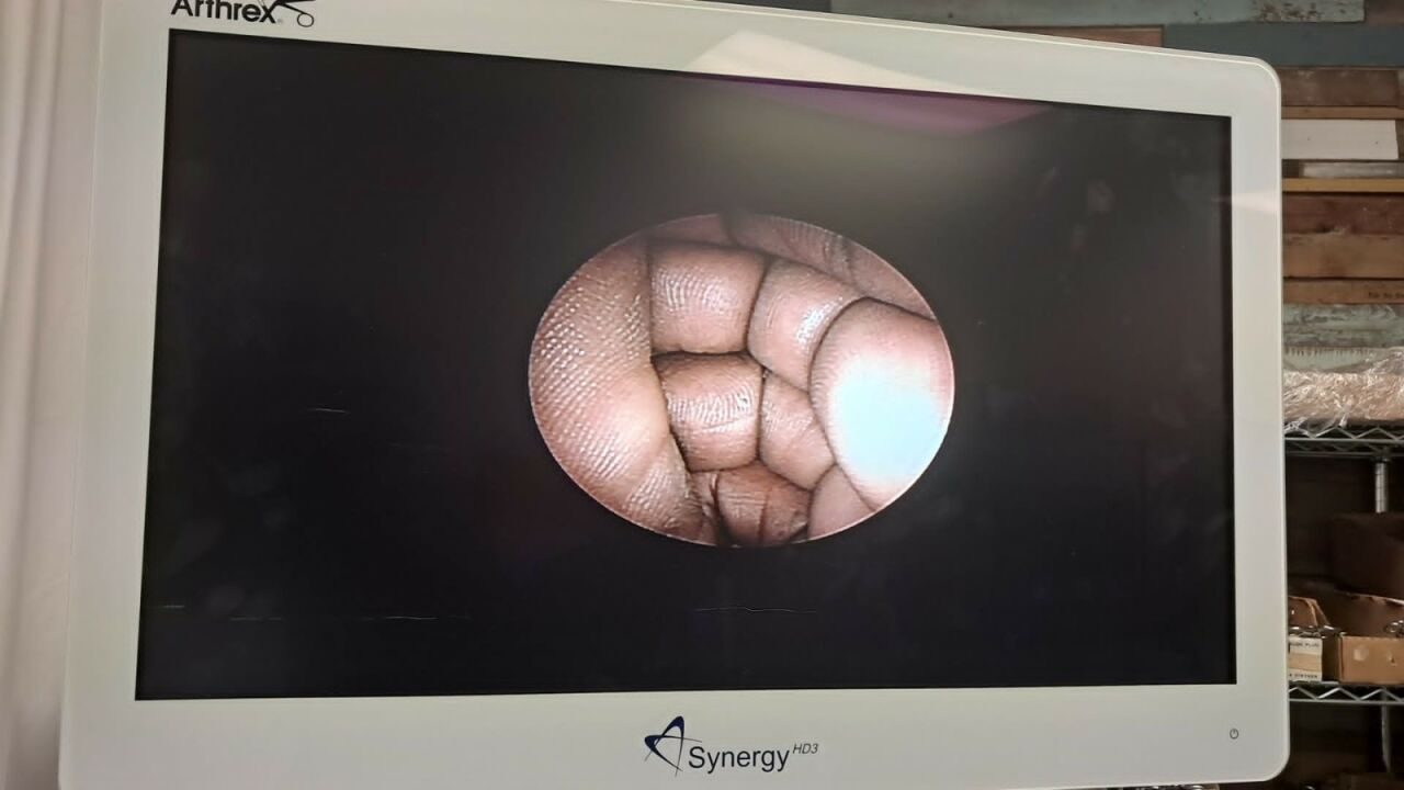 STRYKER 4.0mm 70o Precision IEtm HD Autoclavable C-Mount 140mm Arthroscope — photo 9