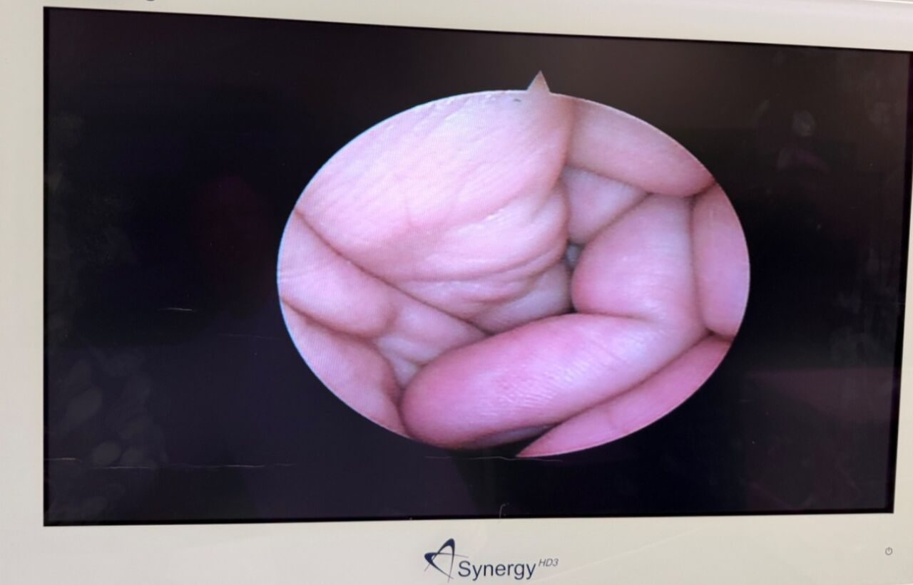 STRYKER 4mm 30deg & 70deg C-Mount Arthroscopes w/ Hardware & Extras Arthroscope — photo 3