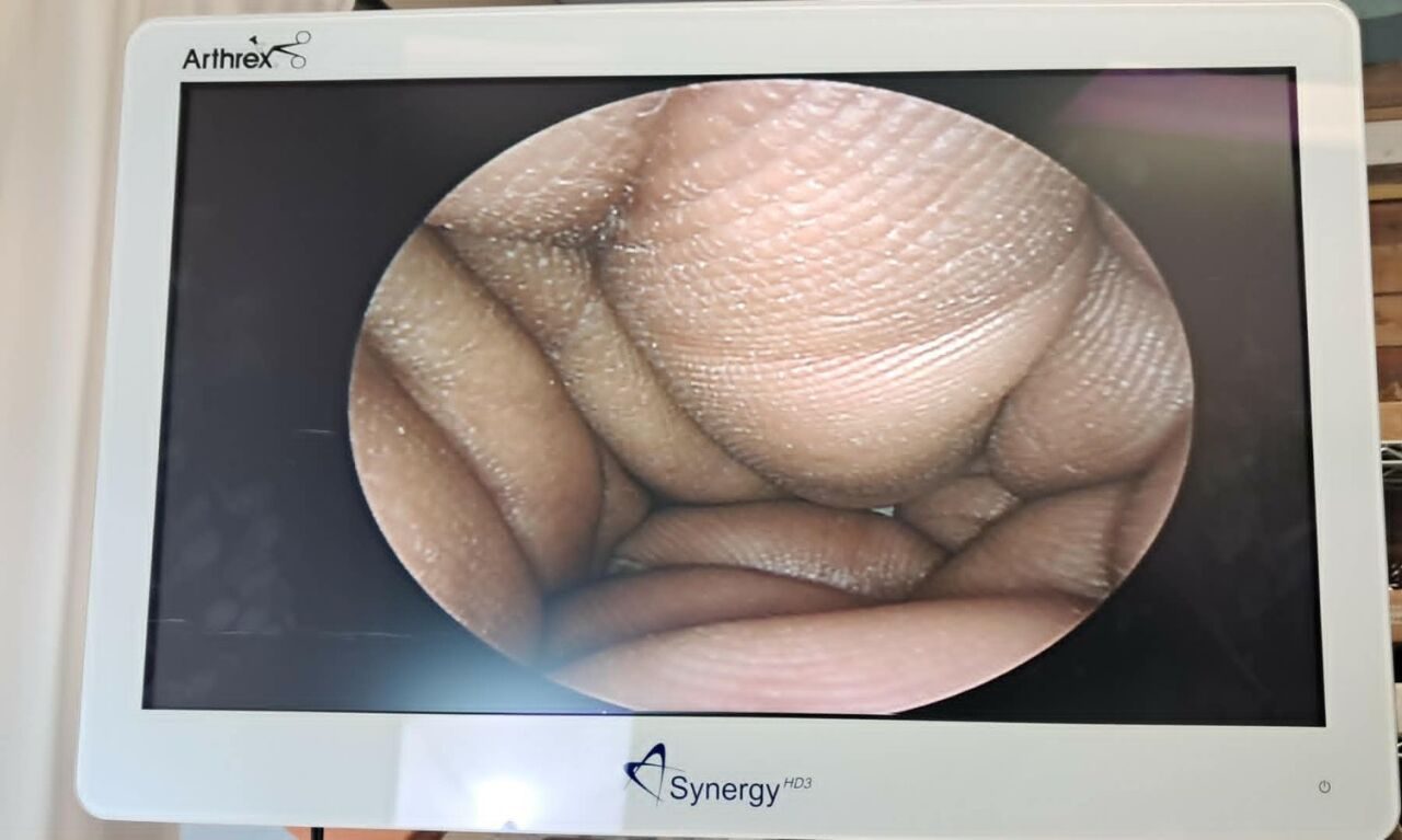 KARL STORZ 7200BW Hopkins 4mm 30deg 17.5cm Arthroscope — photo 7