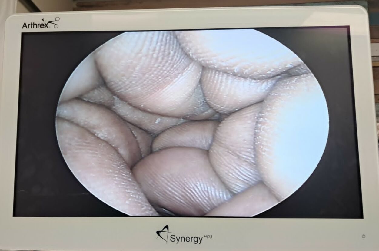 ACMI M3-0A 4.0mm 0o Autoclavable Rigid 29cm Cystoscope — photo 10
