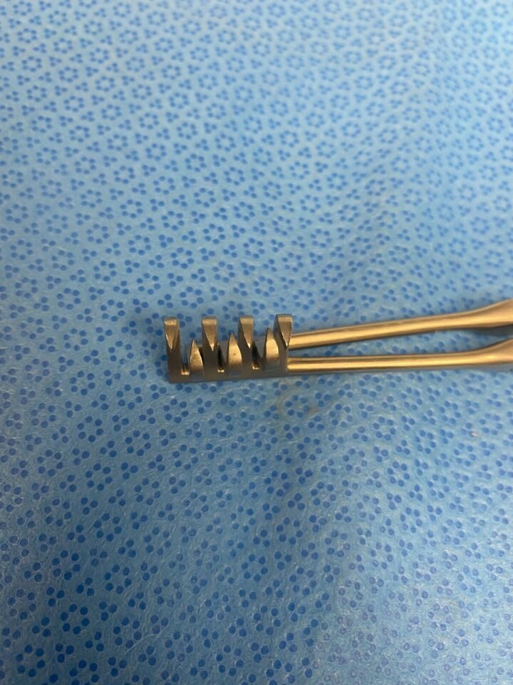 V. MUELLER SU3195 Beckman Retractor Hinged Arms 3 X 4 Sharp Prongs 6-3/4" — photo 5