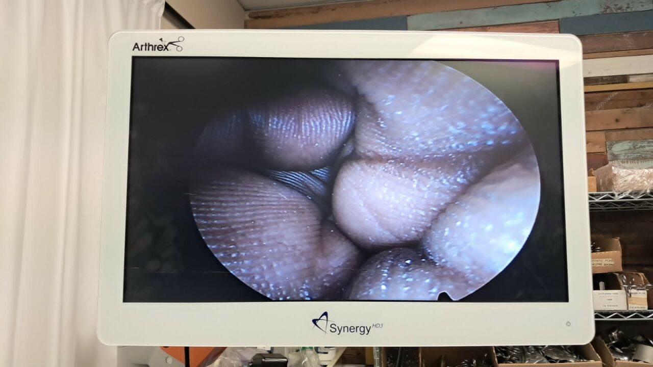 OLYMPUS A2033A Cystoscope — photo 9