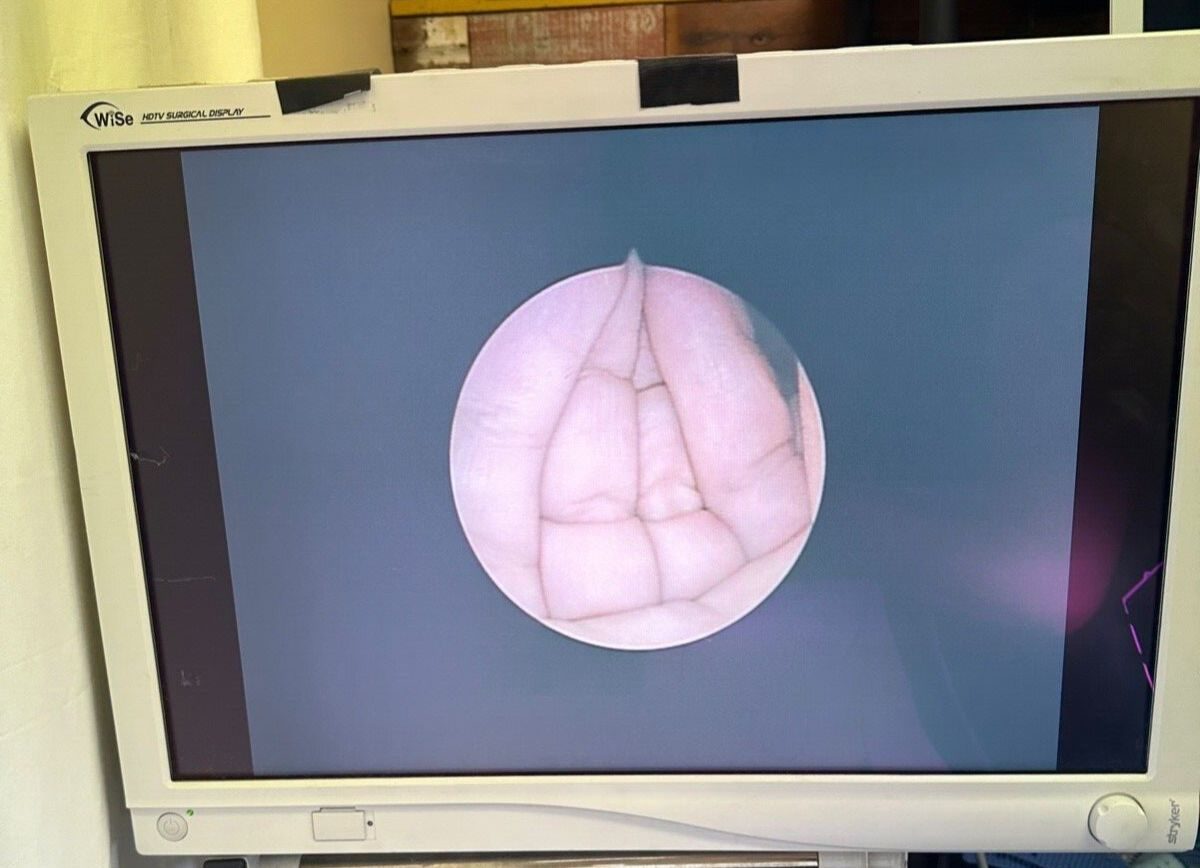 STRYKER 502-904-030 Arthroscope — photo 3