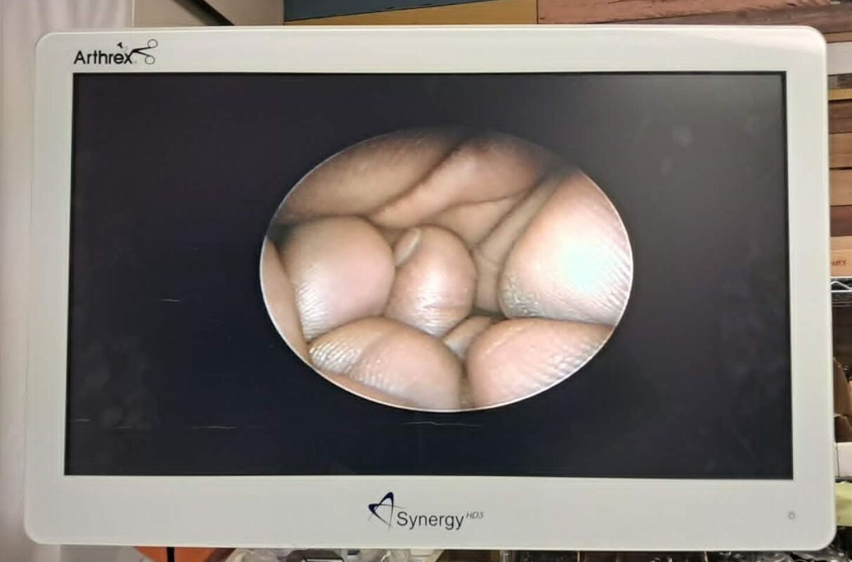 HOLOGIC 50-200XL 7.25mm 0deg Operative Hysteroscope — photo 9